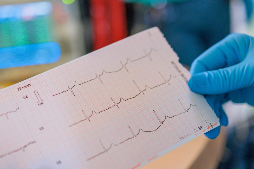 Afbeelding van Pilot zorgpad ‘Pijn op de borst’ op de huisartsenspoedpost